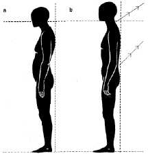 Leland Vall - Improve Your Posture with the Alexander Technique www.freeyourneck.com Leland Vall - Improve Your Posture with the Alexander Technique www.freeyourneck.com